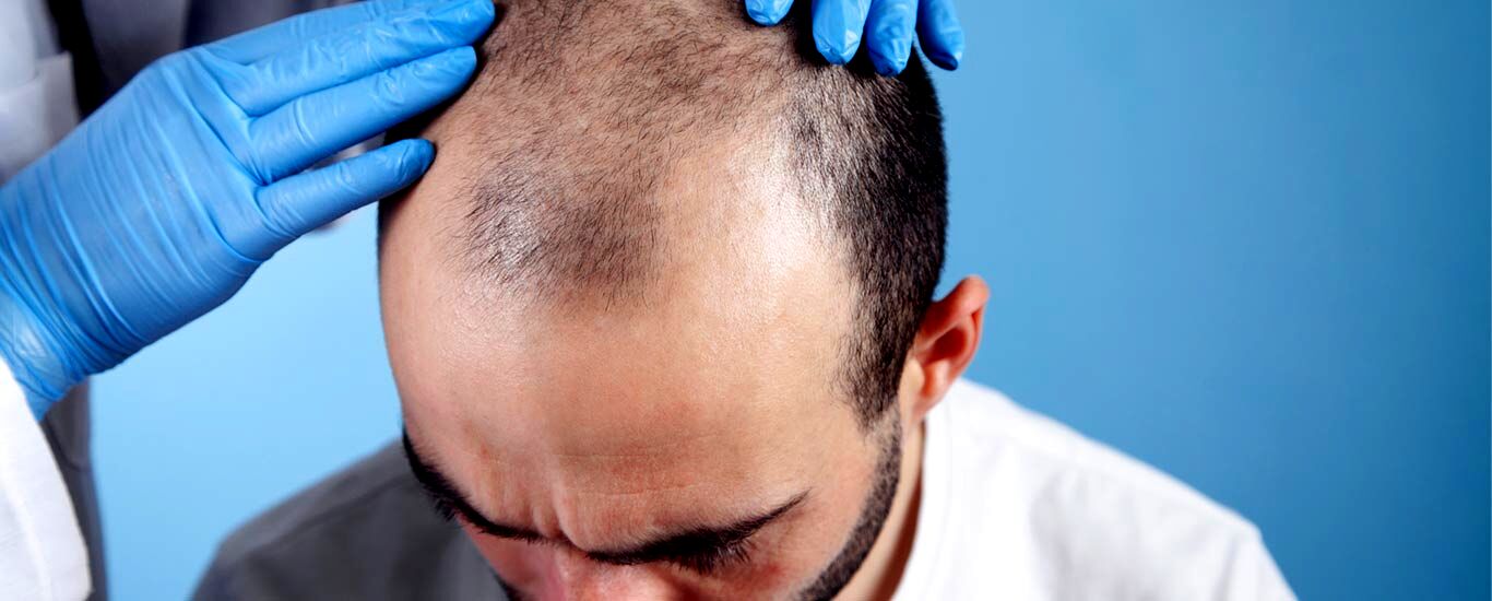مزاج بلغمی یا سرد و تر چیست و چه خصوصیاتی دارد؟ 