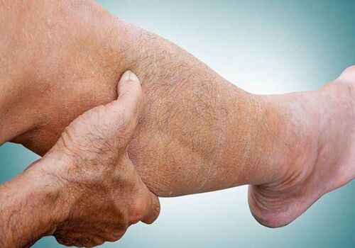 دائما احساس گرفتگی عضله داری؟ این ویتامین ها بهت نرسیده 